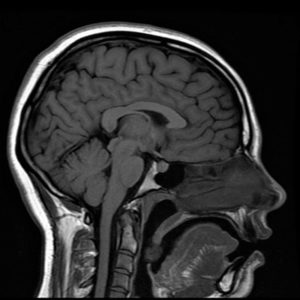 Biological Psychology - Brain Imaging Techniques - MRI - IB Study Guide